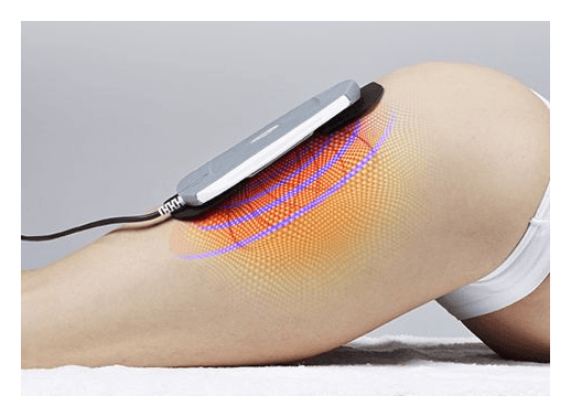 ELITE BODY SYNERGIC PLATE