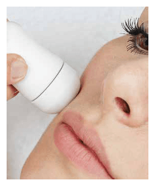 SMART ELECTROPORATION