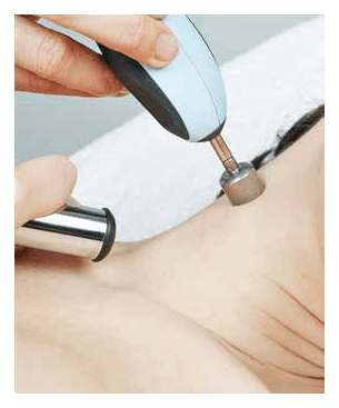 SMART MICRODERMABRASION