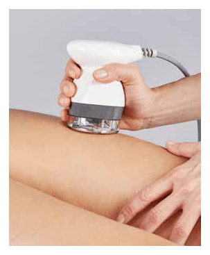 SMART RADIOFREQUENCY